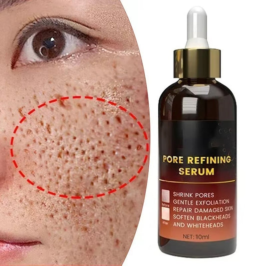 Pore Shrink Face Serum Remove Blackheads Acne Acidity Oil