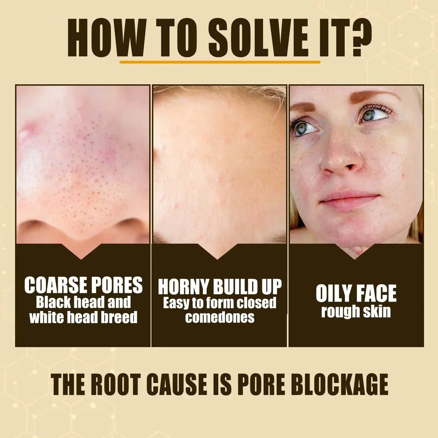 Pore Shrink Face Serum Remove Blackheads Acne Acidity Oil