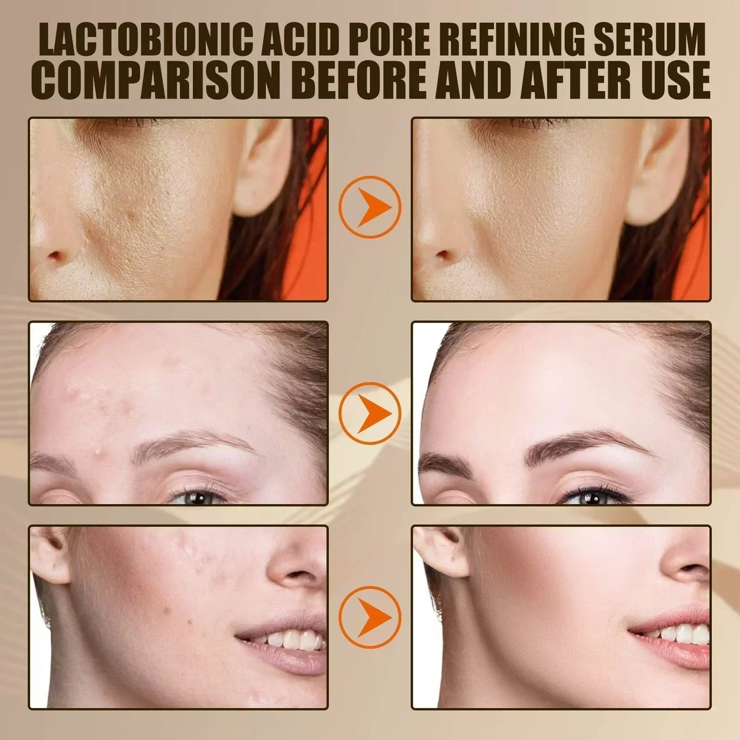 Pore Shrink Face Serum Remove Blackheads Acne Acidity Oil